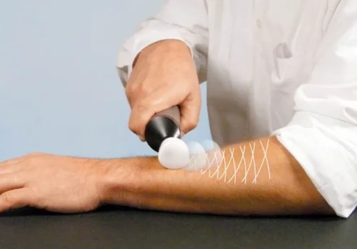 Matrix Rhythm Therapy